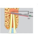 Surgery Diamond FGXXL D254 317 016 burs